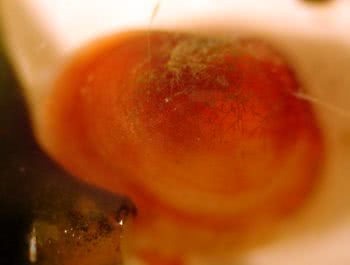 Lasaea adansoni (L. rubra)